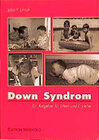 Buchcover Down Syndrom