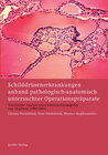 Buchcover Schilddrüsenerkrankungen anhand pathologisch-anatomisch untersuchter Operationspräparate