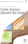 Buchcover 8. Cystic lesions around the knee