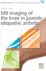 Buchcover 14. MR imaging of the knee in juvenile idiopathic arthritis