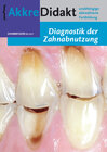 Diagnostik der Zahnabnutzung width=
