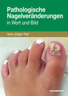 Buchcover Pathologische Nagelveränderungen in Wort und Bild