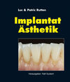 Buchcover Implantat-Ästhetik