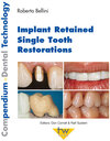 Buchcover Implant Retained Single Tooth Restorations