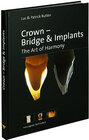 Buchcover Crown - Bridge & Implants