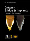 Buchcover Crown, Bridge & Implants