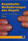 Buchcover Krankhafte Veränderungen des Nagels