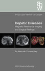 Buchcover Hepatic Diseases
