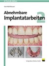 Buchcover Abnehmbare Implantatarbeiten 2