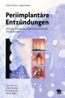 Buchcover Periimplantäre Entzündungen