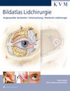 Buchcover Bildatlas Lidchirurgie