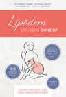 Buchcover Lipödem - Ein Leben ohne OP