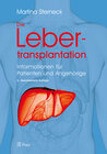 Buchcover Die Lebertransplantation