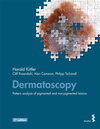 Buchcover Dermatoscopy