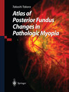 Buchcover Atlas of Posterior Fundus Changes in Pathologic Myopia