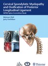 Buchcover Cervical Spondylotic Myelopathy and Ossification of Posterior Longitudinal Ligament