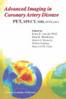 Buchcover Advanced Imaging in Coronary Artery Disease
