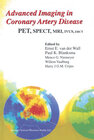 Buchcover Advanced Imaging in Coronary Artery Disease