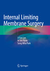 Buchcover Internal Limiting Membrane Surgery